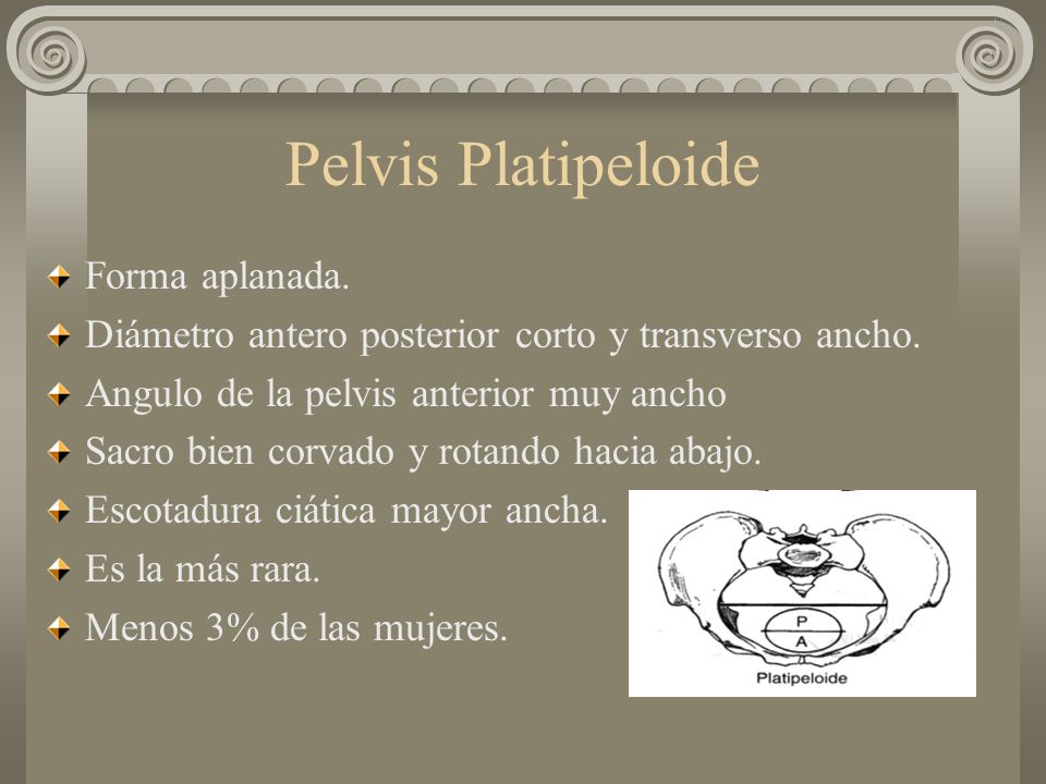 Pelvis Platipeloide Forma aplanada.
