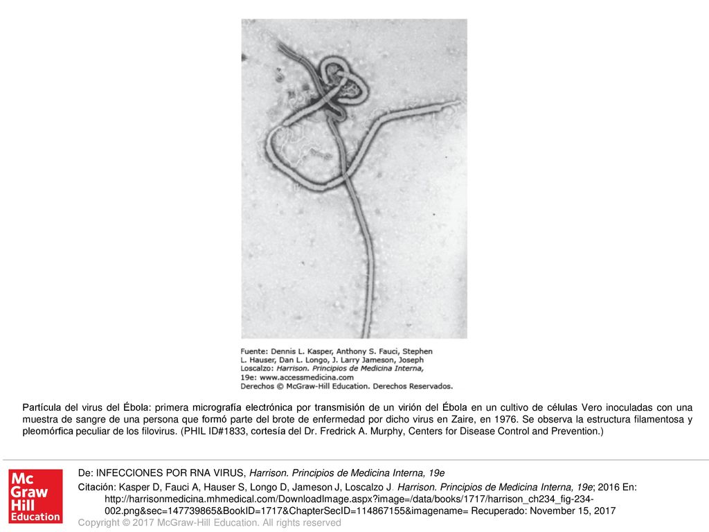 Partícula del virus del Ébola: primera micrografía electrónica por transmisión de un virión del Ébola en un cultivo de células Vero inoculadas con una muestra de sangre de una persona que formó parte del brote de enfermedad por dicho virus en Zaire, en Se observa la estructura filamentosa y pleomórfica peculiar de los filovirus. (PHIL ID#1833, cortesía del Dr. Fredrick A. Murphy, Centers for Disease Control and Prevention.)
