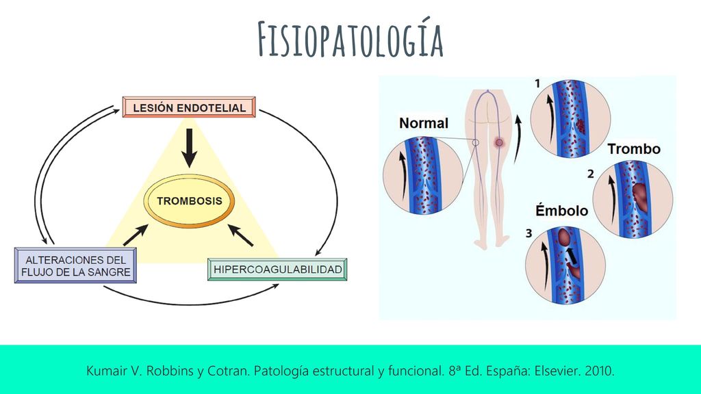 Fisiopatología Kumair V. Robbins y Cotran. Patología estructural y funcional.