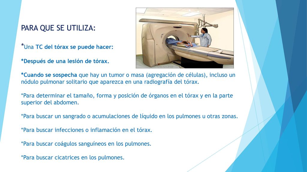 PARA QUE SE UTILIZA:. Una TC del tórax se puede hacer: