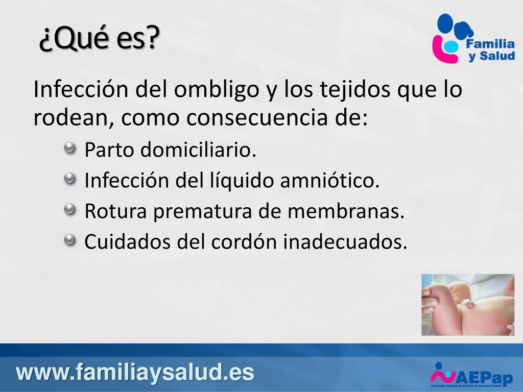 ¿Qué es Infección del ombligo y los tejidos que lo rodean, como consecuencia de: Parto domiciliario.