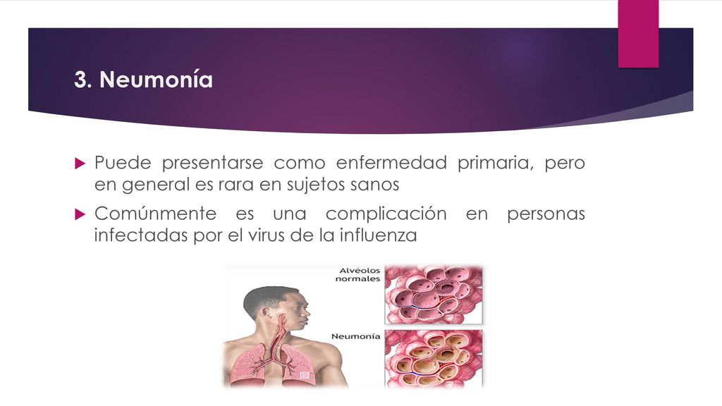 3. Neumonía Puede presentarse como enfermedad primaria, pero en general es rara en sujetos sanos.