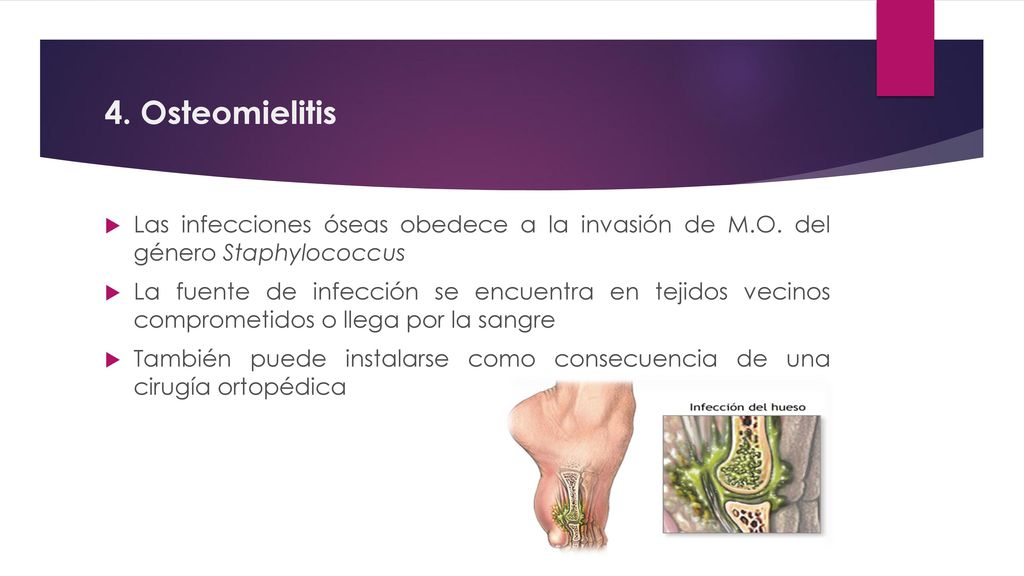 4. Osteomielitis Las infecciones óseas obedece a la invasión de M.O. del género Staphylococcus.