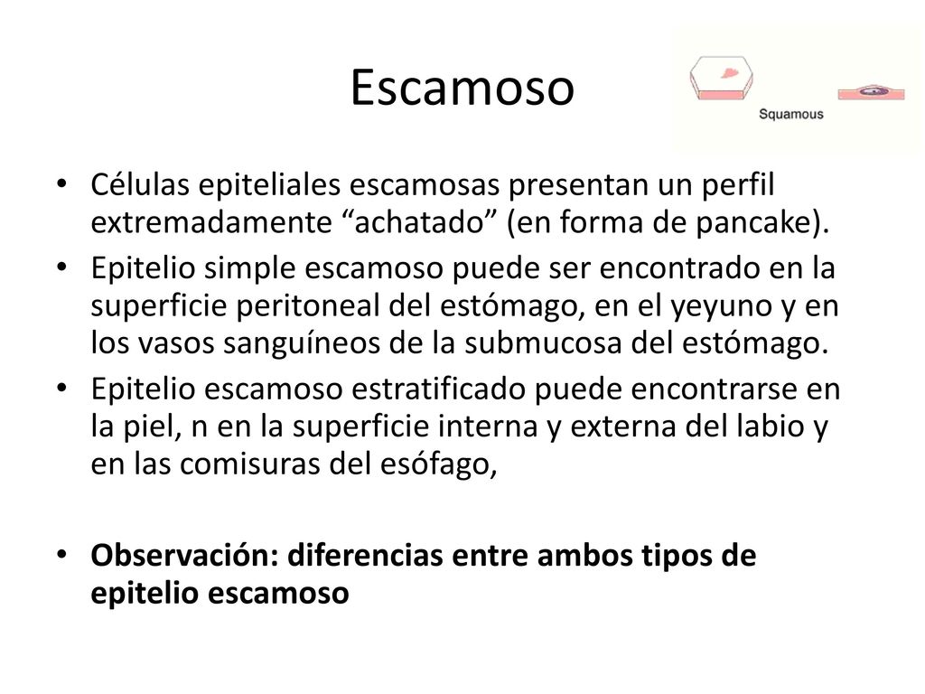 Escamoso Células epiteliales escamosas presentan un perfil extremadamente achatado (en forma de pancake).