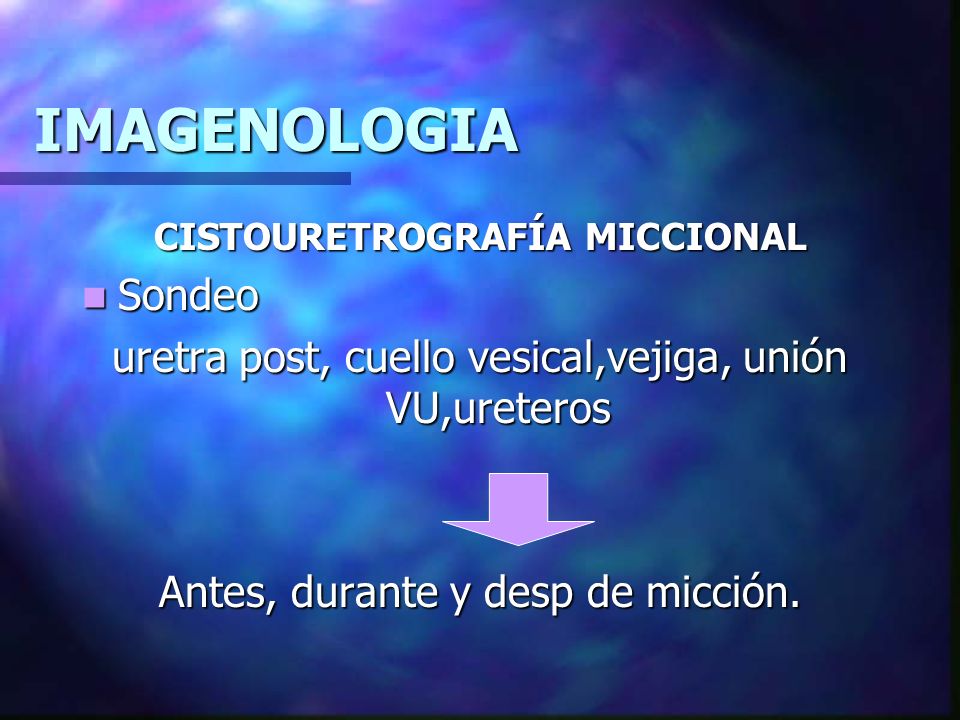 IMAGENOLOGIA CISTOURETROGRAFÍA MICCIONAL. Sondeo. uretra post, cuello vesical,vejiga, unión VU,ureteros.