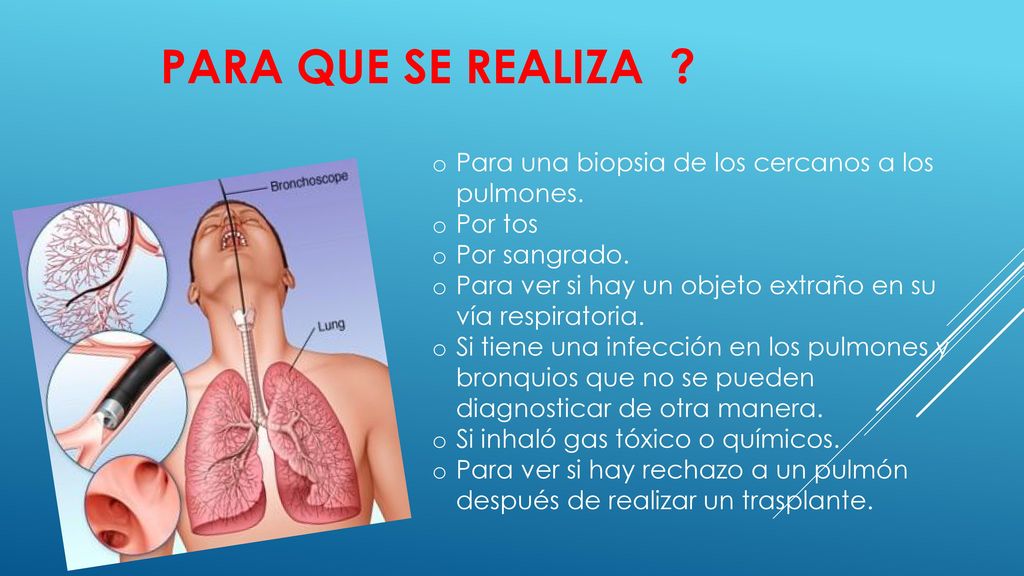 Para que se realiza Para una biopsia de los cercanos a los pulmones.