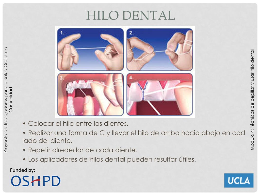 Hilo dental Proyecto de Trabajadores para la Salud Oral en la Comunidad. Modulo 4: Técnicas de cepillar y usar hilo dental.