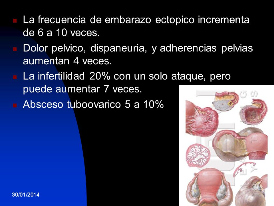 La frecuencia de embarazo ectopico incrementa de 6 a 10 veces.