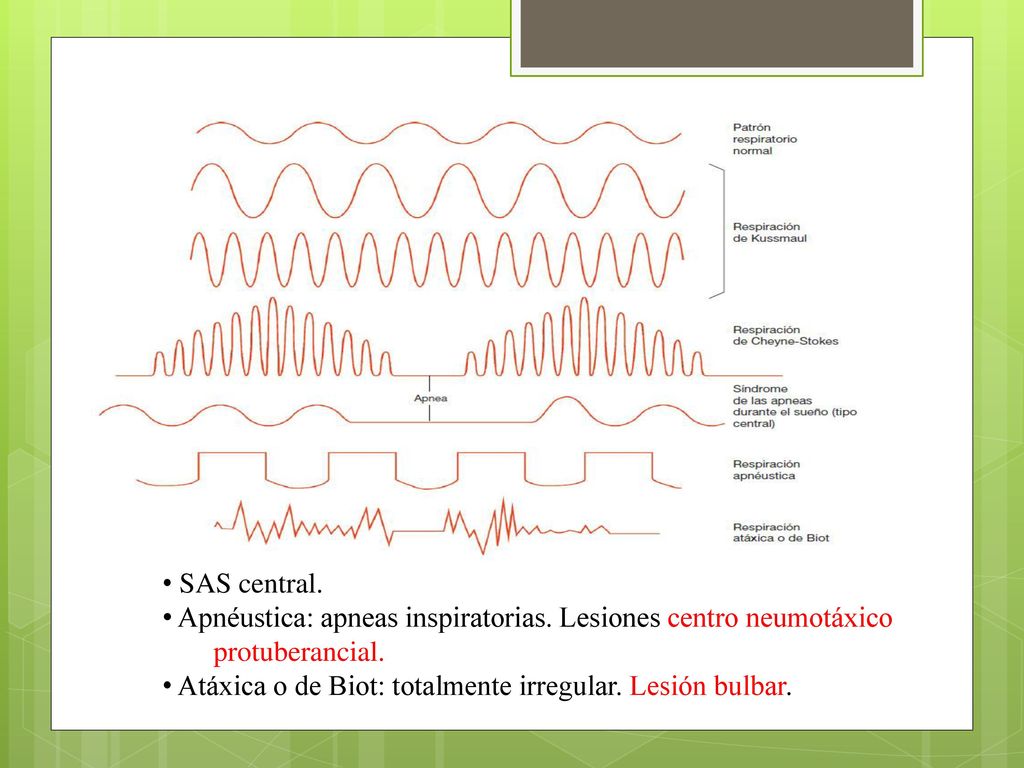 SAS central. Apnéustica: apneas inspiratorias. Lesiones centro neumotáxico protuberancial.