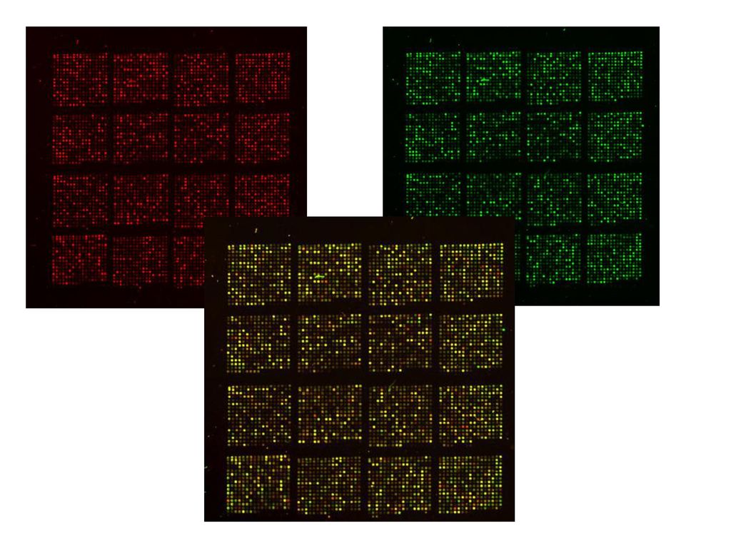 SE OBSERVA puntos amarillos, verdes, rojos y un sin numero de tonalidades entre el verde y el rojo. Si para este experimento se marcó la muestra experimental en rojo y la control en verde, todos aquellos puntos que se ven rojos o tonalidades anaranjadas, pueden ser interpretados como genes que aumentaron su expresión.