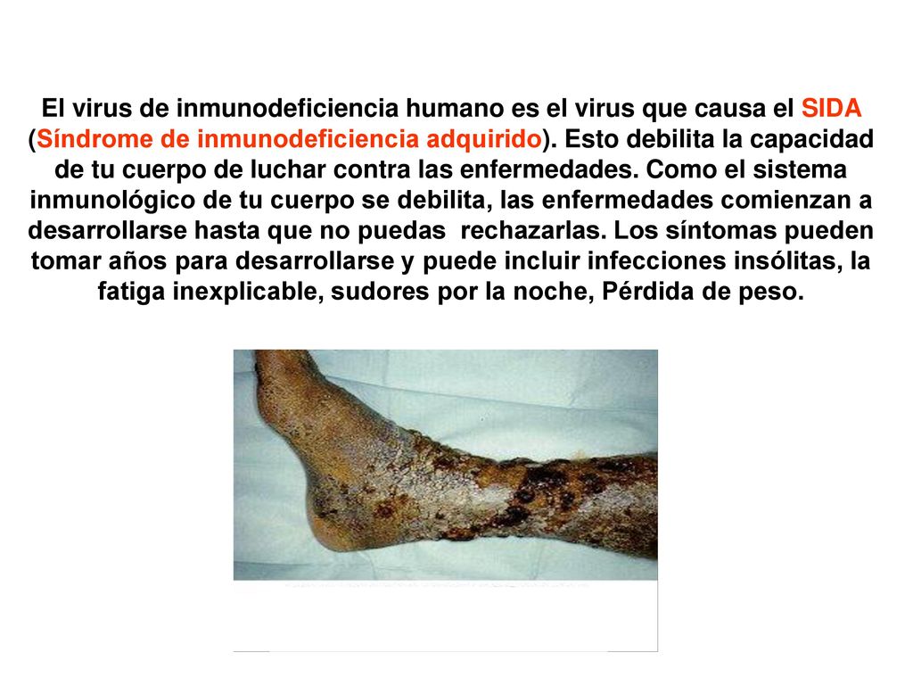 El virus de inmunodeficiencia humano es el virus que causa el SIDA (Síndrome de inmunodeficiencia adquirido).