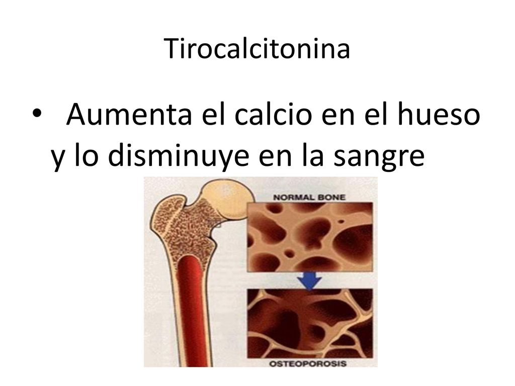 Aumenta el calcio en el hueso y lo disminuye en la sangre