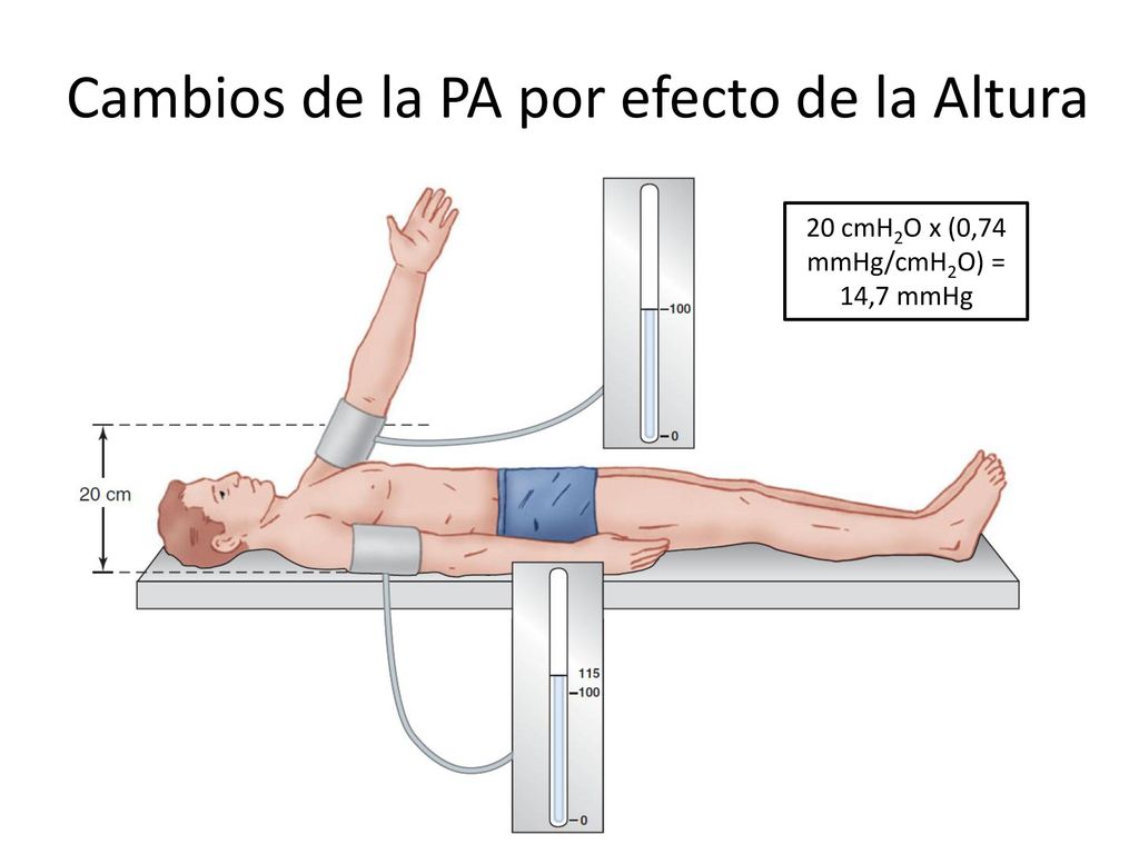 Cambios de la PA por efecto de la Altura