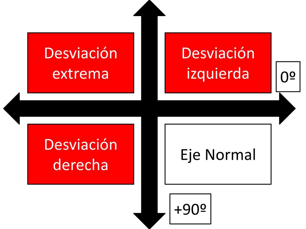 Desviación extrema Desviación izquierda 0º Desviación derecha Eje Normal +90º