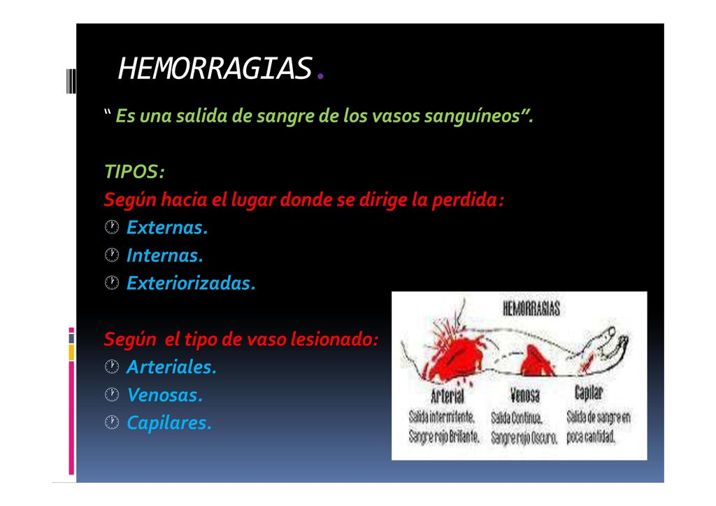 HEMORRAGIAS. Es una salida de sangre de los vasos sanguíneos .