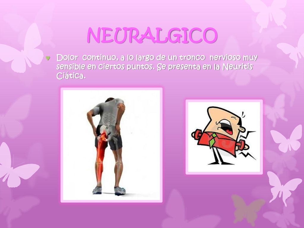 NEURALGICO Dolor continuo, a lo largo de un tronco nervioso muy sensible en ciertos puntos.