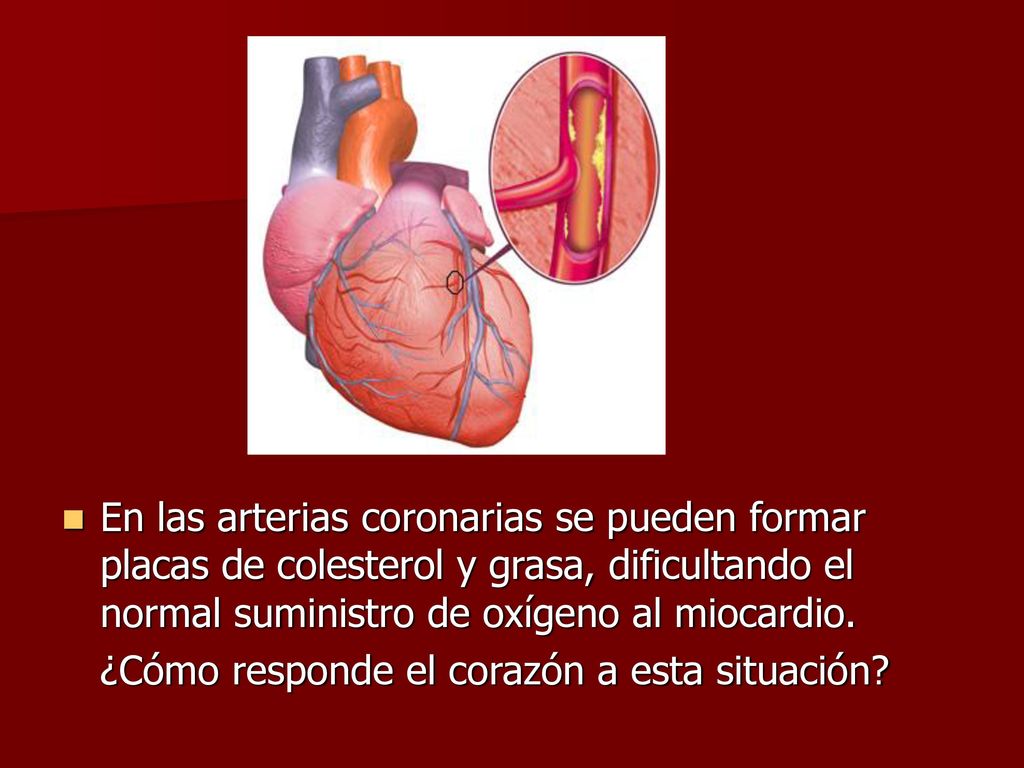 En las arterias coronarias se pueden formar placas de colesterol y grasa, dificultando el normal suministro de oxígeno al miocardio.