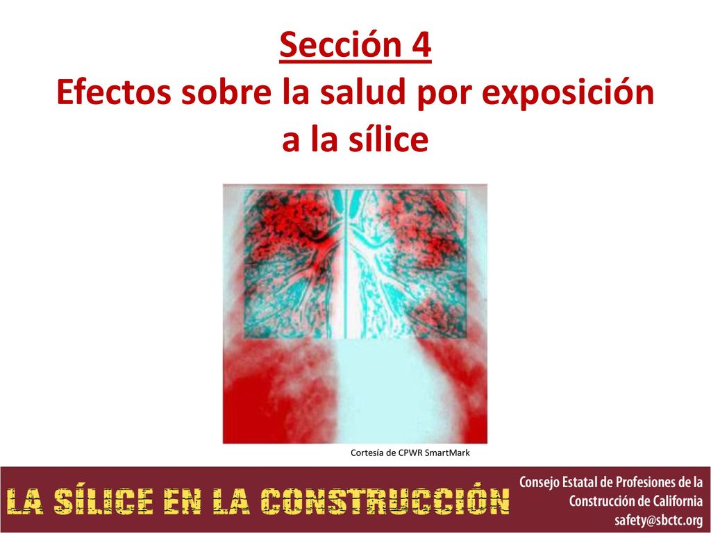 Sección 4 Efectos sobre la salud por exposición a la sílice