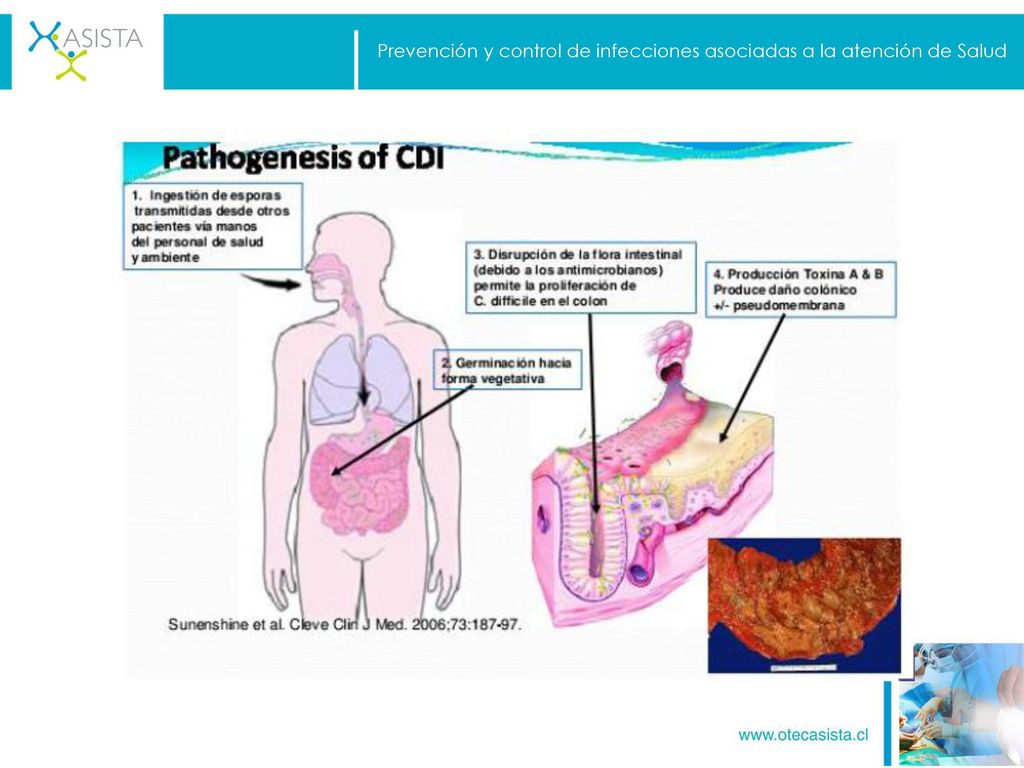 Prevención y control de infecciones asociadas a la atención de Salud