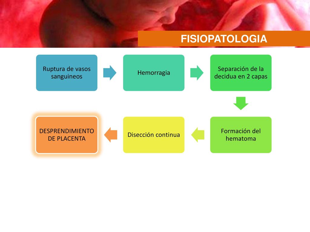 FISIOPATOLOGIA Ruptura de vasos sanguineos. Hemorragia. Separación de la decidua en 2 capas. Formación del hematoma.