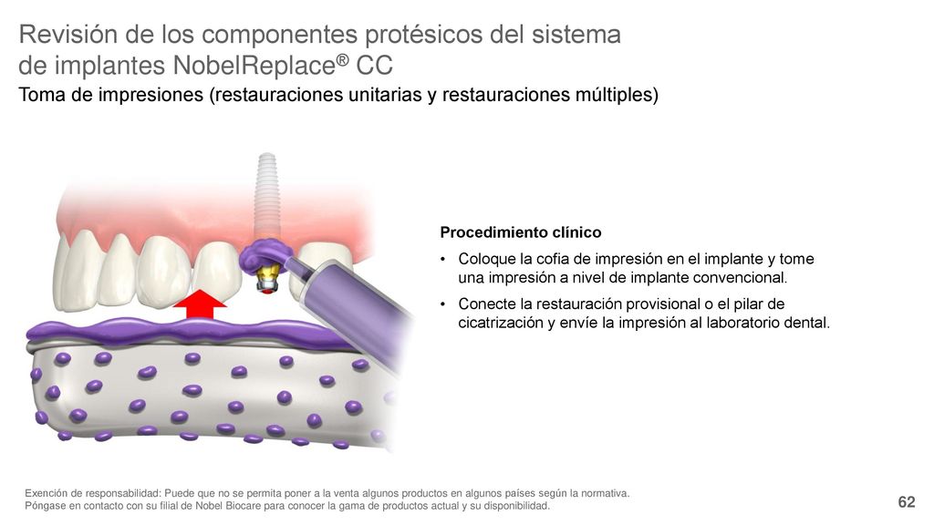 Revisión de los componentes protésicos del sistema de implantes NobelReplace® CC
