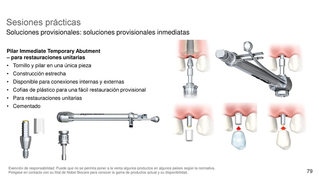 Sesiones prácticas Soluciones provisionales: soluciones provisionales inmediatas. Pilar Immediate Temporary Abutment.