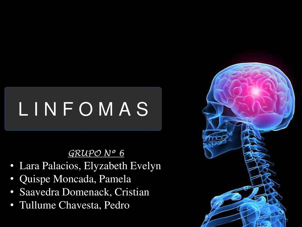 L I N F O M A S Lara Palacios, Elyzabeth Evelyn Quispe Moncada, Pamela