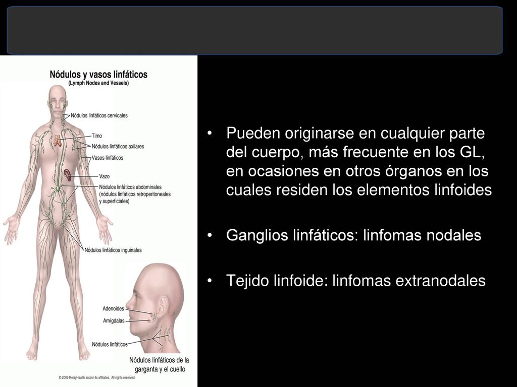 Pueden originarse en cualquier parte del cuerpo, más frecuente en los GL, en ocasiones en otros órganos en los cuales residen los elementos linfoides