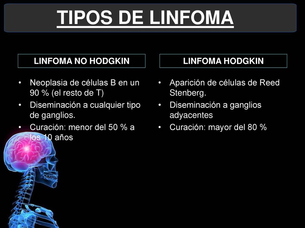 TIPOS DE LINFOMA LINFOMA NO HODGKIN LINFOMA HODGKIN