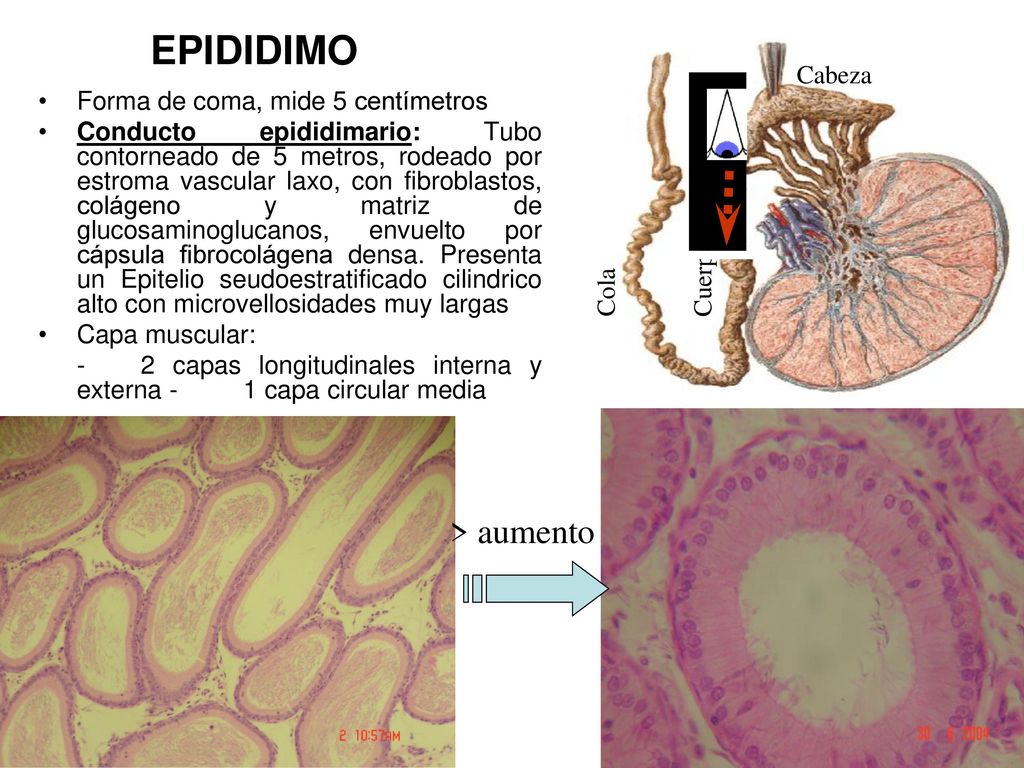 EPIDIDIMO > aumento Cabeza Forma de coma, mide 5 centímetros