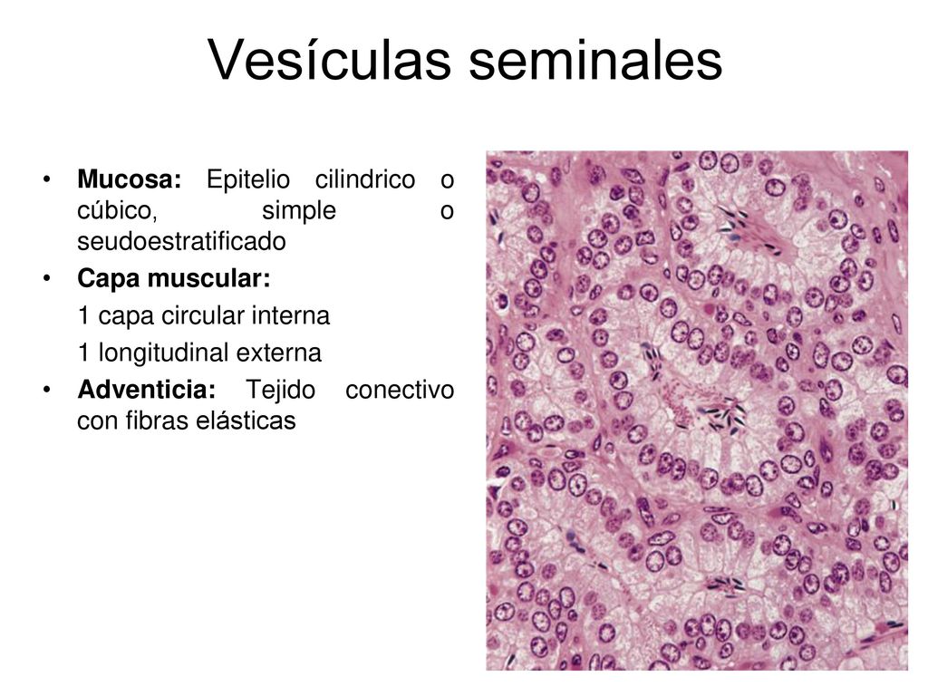 Vesículas seminales Mucosa: Epitelio cilindrico o cúbico, simple o seudoestratificado. Capa muscular: