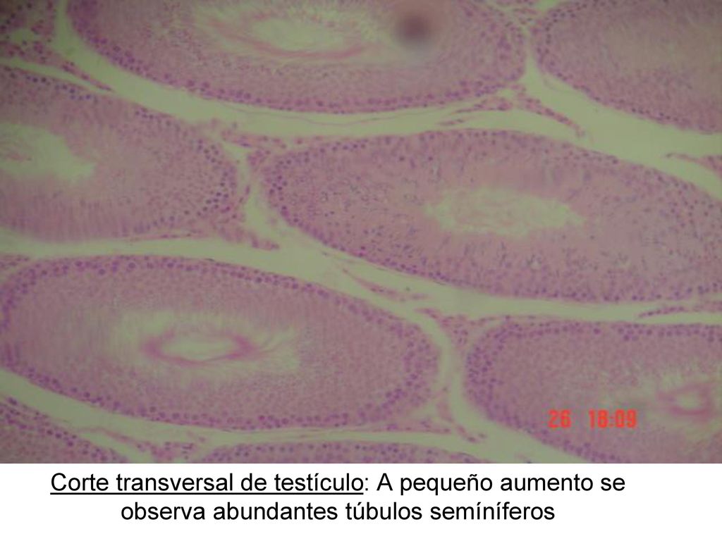 Corte transversal de testículo: A pequeño aumento se observa abundantes túbulos semíníferos
