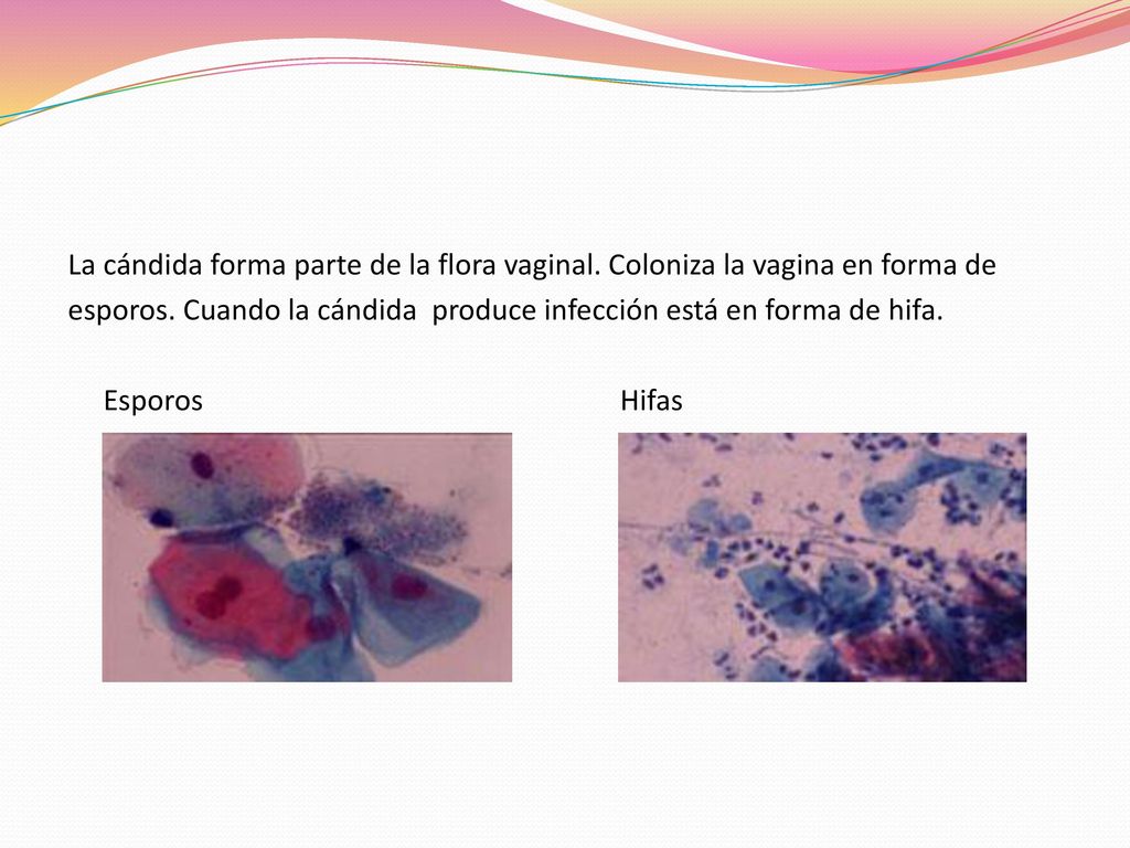 La cándida forma parte de la flora vaginal