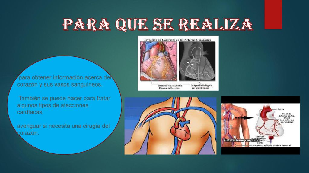 PARA QUE SE REALIZA para obtener información acerca del corazón y sus vasos sanguíneos.
