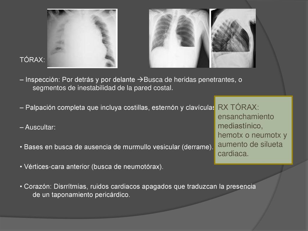 TÓRAX: – Inspección: Por detrás y por delante Busca de heridas penetrantes, o segmentos de inestabilidad de la pared costal.