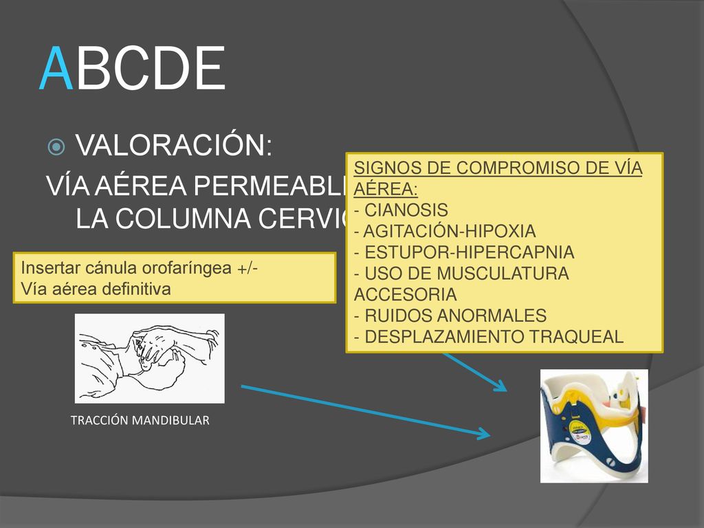 ABCDE VALORACIÓN: VÍA AÉREA PERMEABLE  CONTROL DE LA COLUMNA CERVICAL