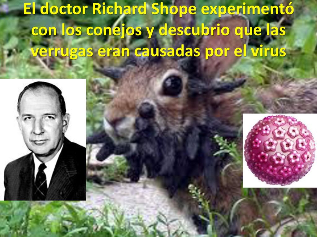 El doctor Richard Shope experimentó con los conejos y descubrio que las verrugas eran causadas por el virus