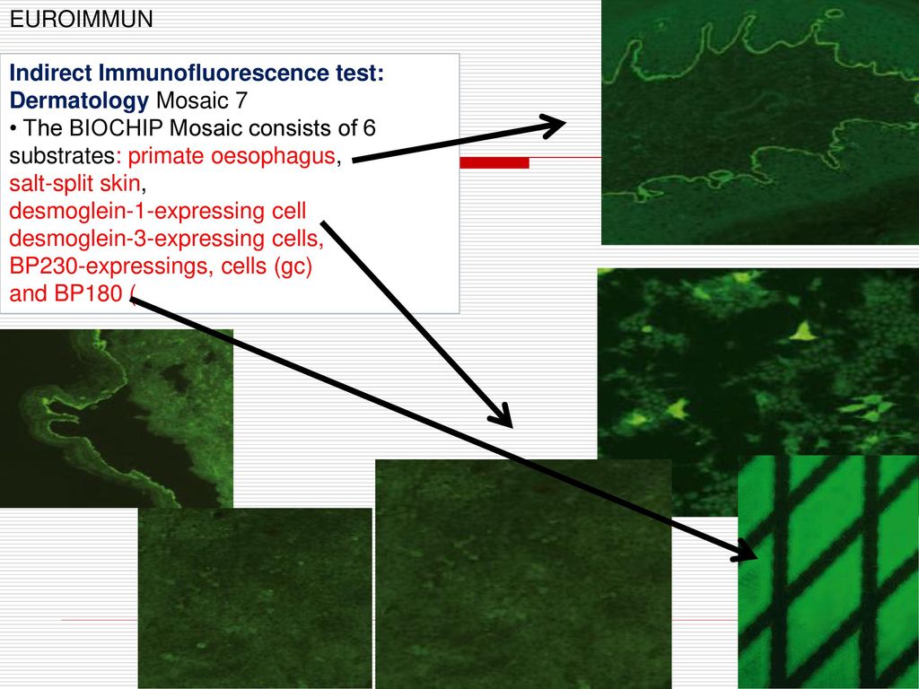 EUROIMMUN Indirect Immunofluorescence test: Dermatology Mosaic 7. • The BIOCHIP Mosaic consists of 6 substrates: primate oesophagus,