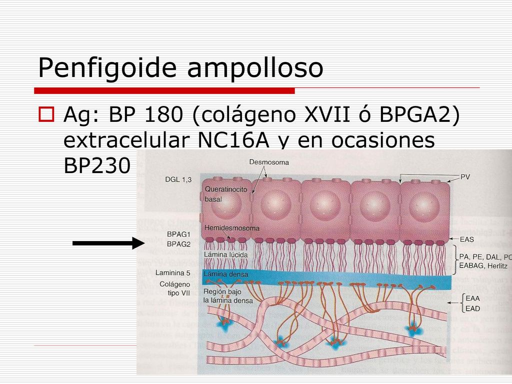 Penfigoide ampolloso Ag: BP 180 (colágeno XVII ó BPGA2) extracelular NC16A y en ocasiones BP230