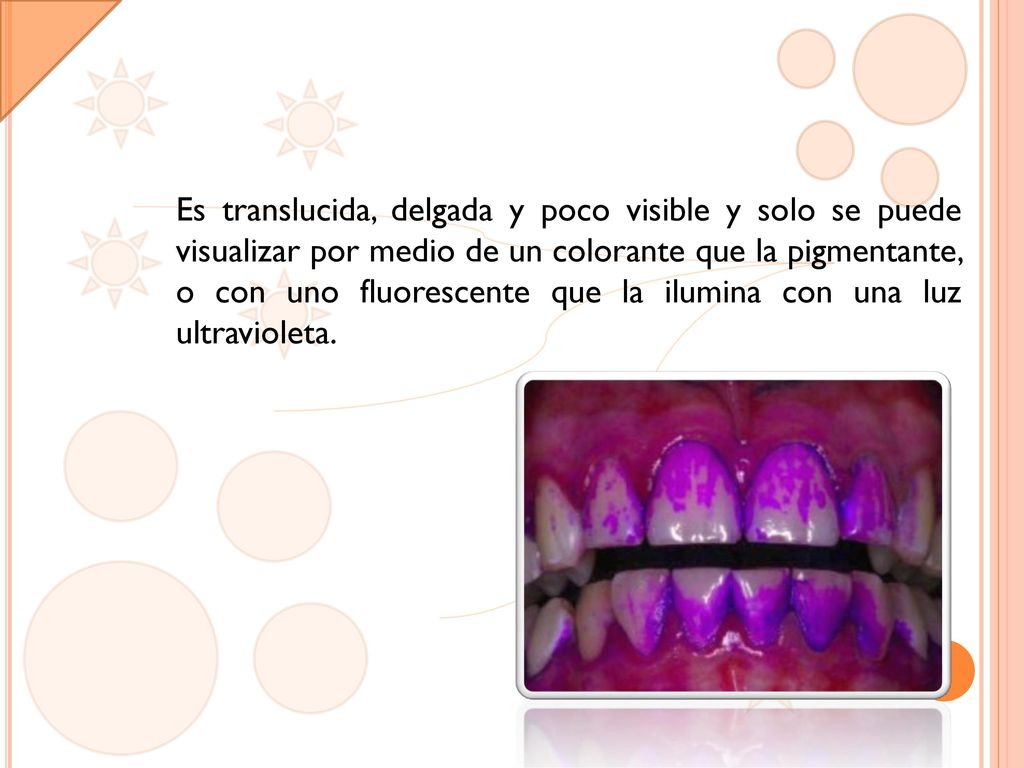 Es translucida, delgada y poco visible y solo se puede visualizar por medio de un colorante que la pigmentante, o con uno fluorescente que la ilumina con una luz ultravioleta.