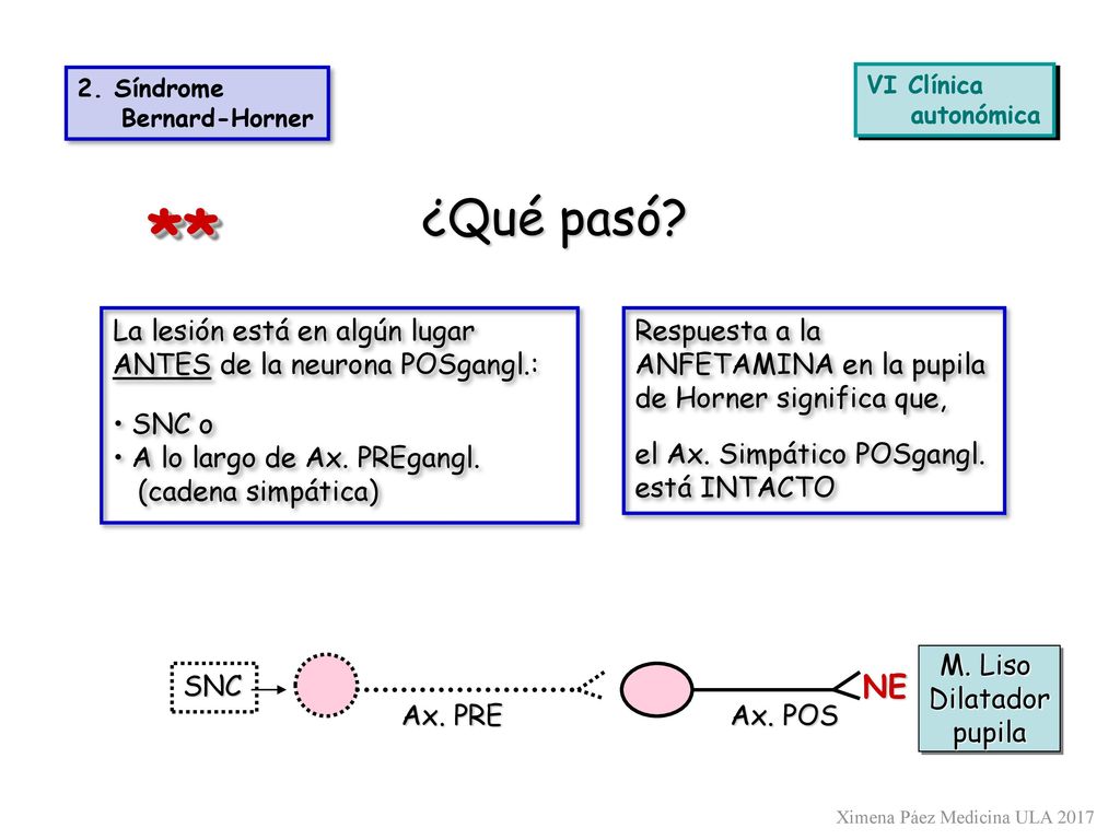 2. Síndrome Bernard-Horner. VI Clínica. autonómica. ¿Qué pasó ** La lesión está en algún lugar ANTES de la neurona POSgangl.: