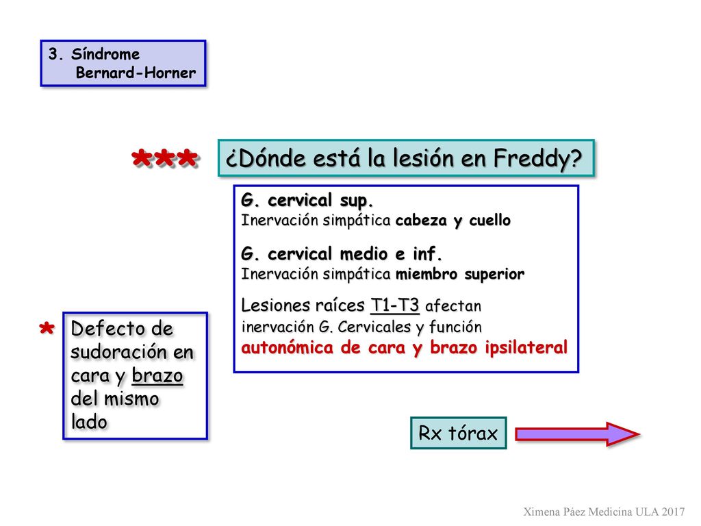*** * ¿Dónde está la lesión en Freddy Defecto de sudoración en