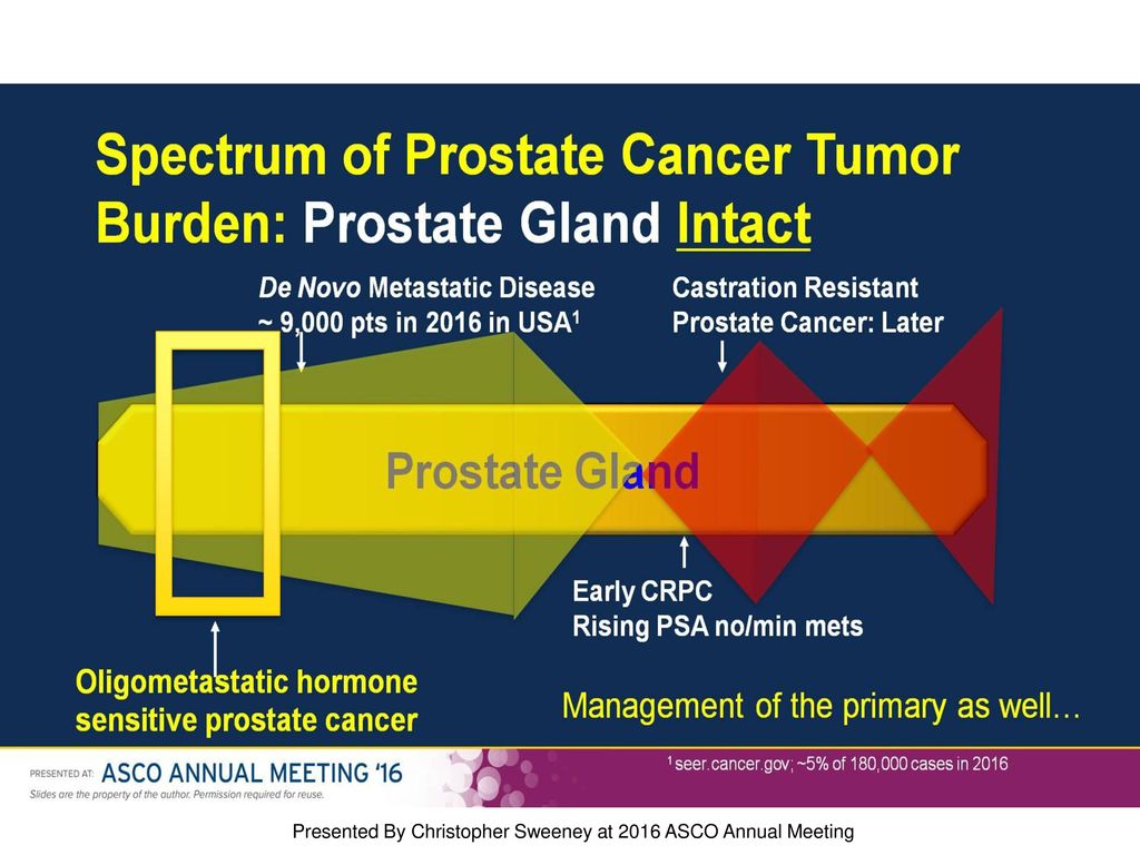 Spectrum of Prostate Cancer Tumor Burden: Prostate Gland Intact