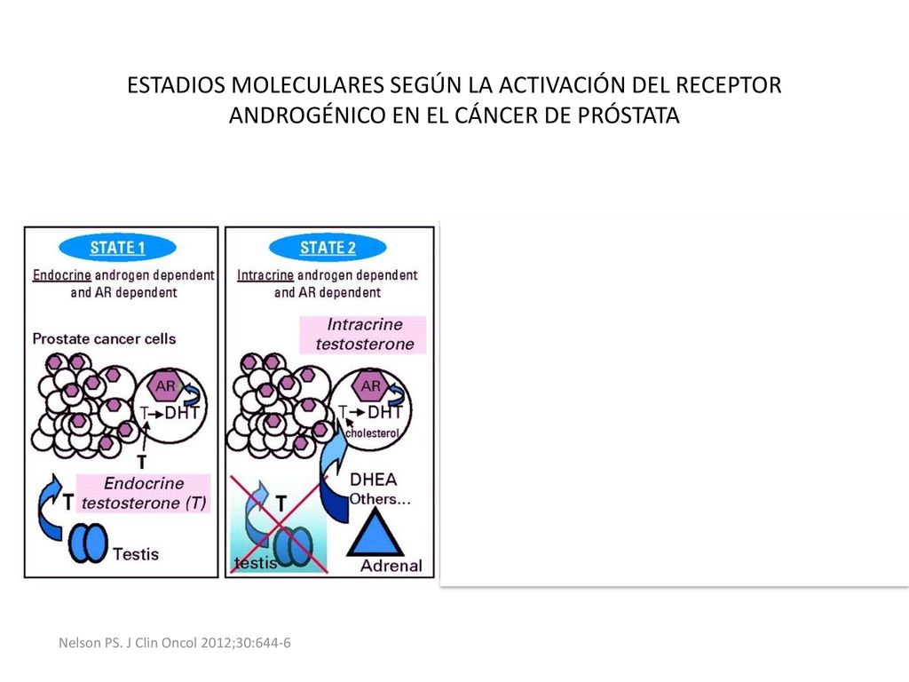 ESTADIOS MOLECULARES SEGÚN LA ACTIVACIÓN DEL RECEPTOR ANDROGÉNICO EN EL CÁNCER DE PRÓSTATA