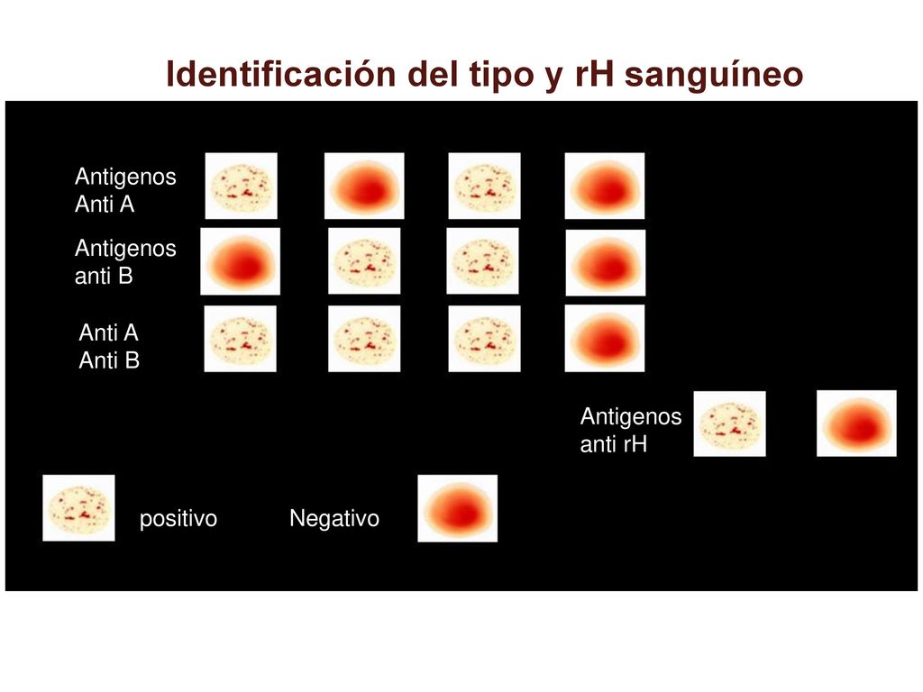 Identificación del tipo y rH sanguíneo