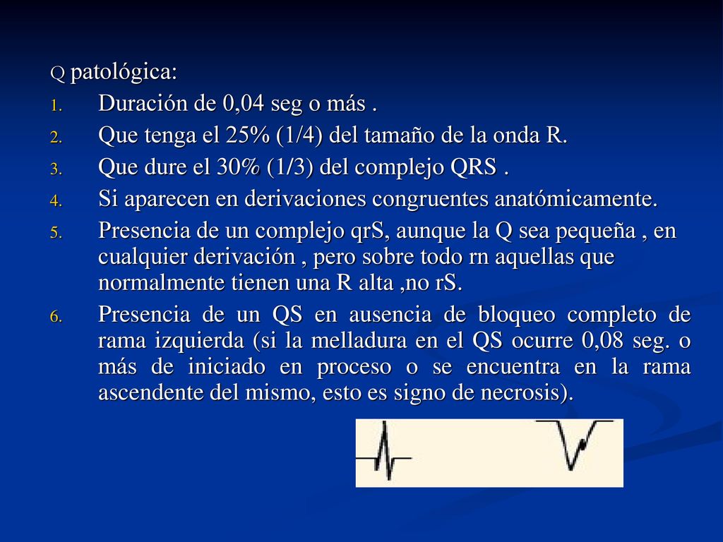 Que tenga el 25% (1/4) del tamaño de la onda R.