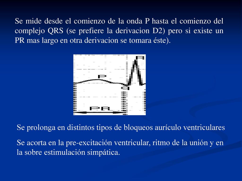 Se mide desde el comienzo de la onda P hasta el comienzo del complejo QRS (se prefiere la derivacion D2) pero si existe un PR mas largo en otra derivacion se tomara éste).