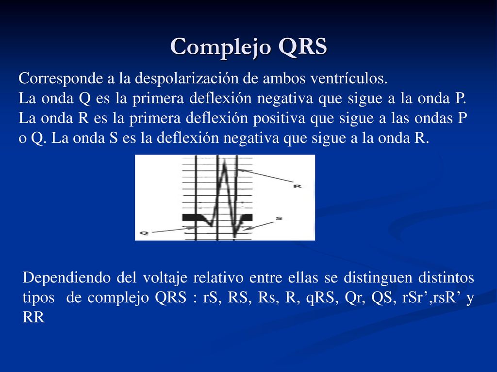 Complejo QRS Corresponde a la despolarización de ambos ventrículos.