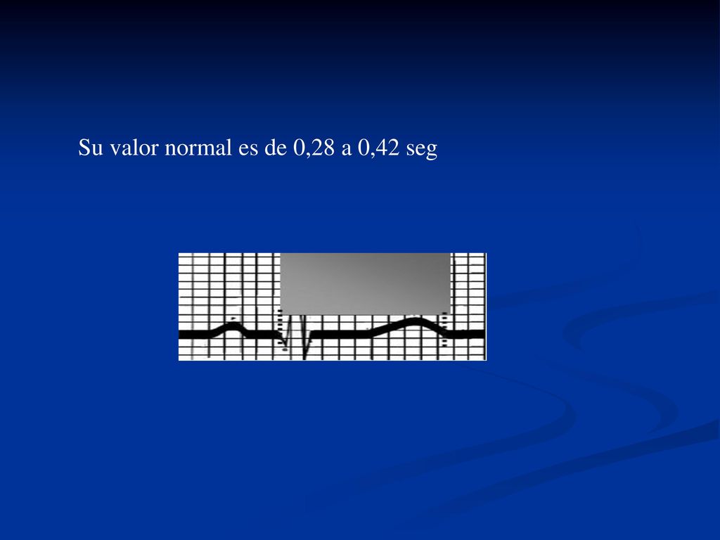 Su valor normal es de 0,28 a 0,42 seg