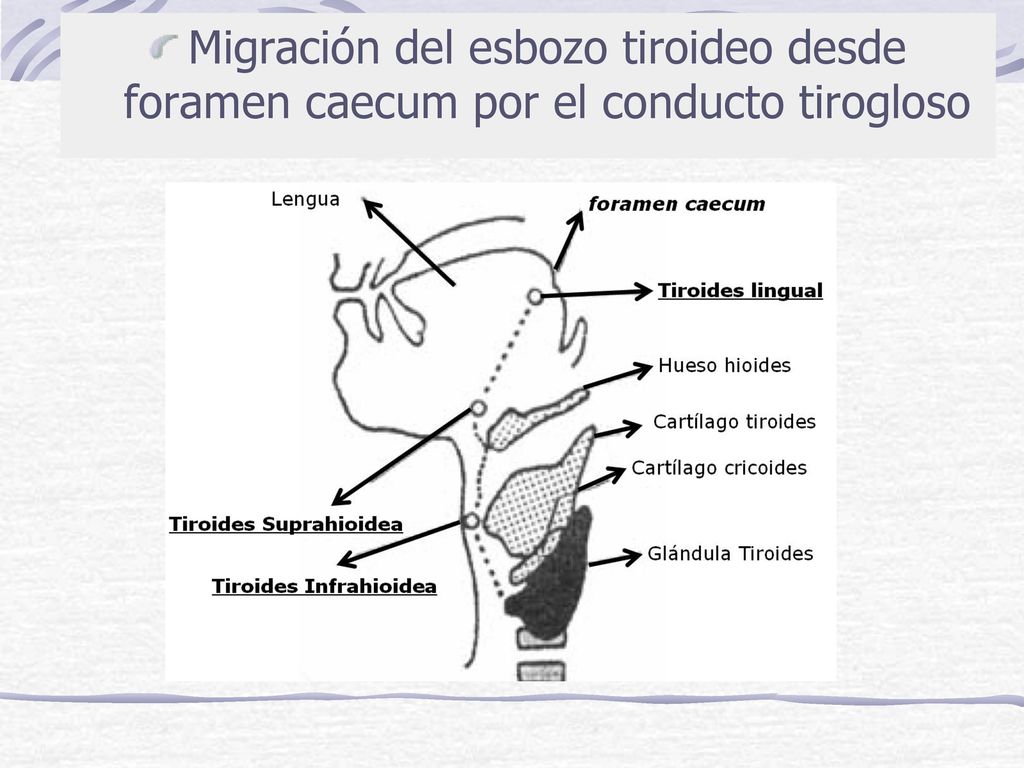Migración del esbozo tiroideo desde foramen caecum por el conducto tirogloso